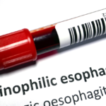 EosinophilicEsophagitis_Blog