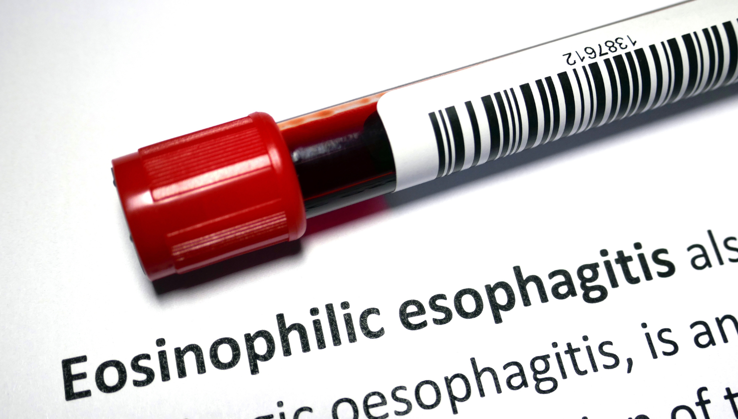 EosinophilicEsophagitis_Blog